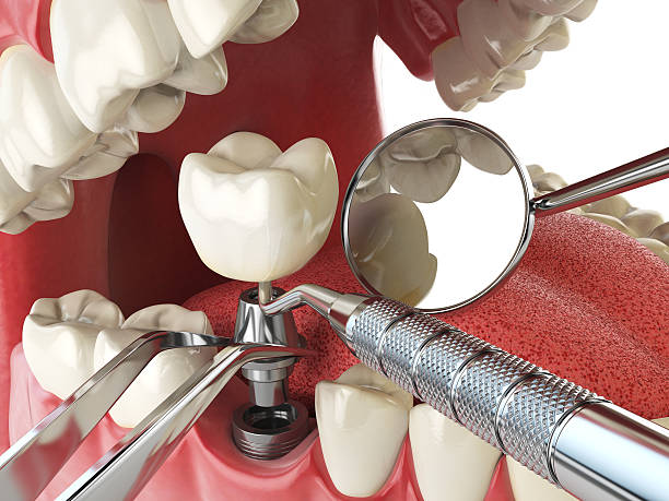 Best Urgent Care for Lost Fillings or Crowns in Belle Meade, TN